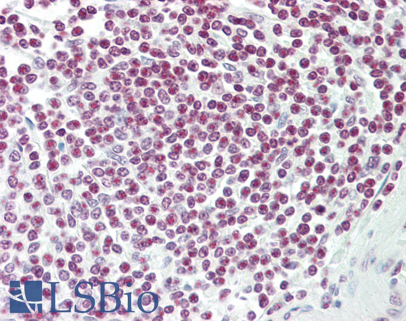 IHC-plus™ C/EBP Epsilon / CEBPE Antibody (aa191-240)