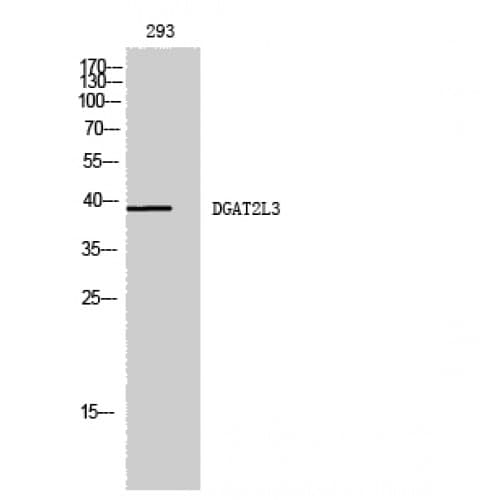 Polyclonal Rabbit anti-Human AWAT1 / DGAT2L3 Antibody (230-310 aa, C-terminal, WB)