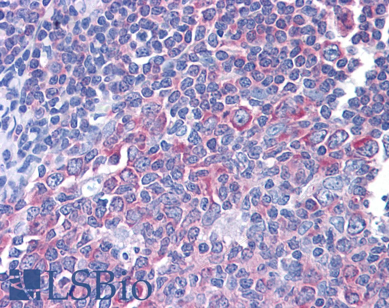 IHC-plus™ RPS17 / Ribosomal Protein S17 Antibody (clone 2C7)