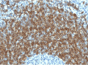CD79B / CD79 Beta Antibody (clone CDLA79b-1)