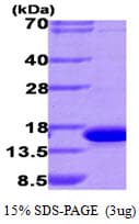 Human LGALS9 / Galectin 9 Protein (Recombinant His)