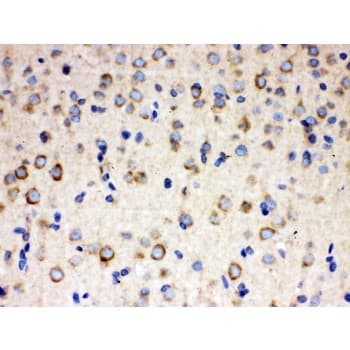 Polyclonal Rabbit anti-Human ULK3 Antibody (aa427-454, IHC, WB)