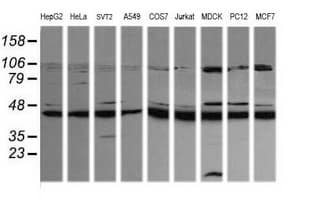 MAP2K1 / MKK1 / MEK1 Antibody (clone OTI1E5)