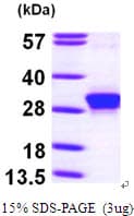 Human RHOE / RND3 Protein (Recombinant His)