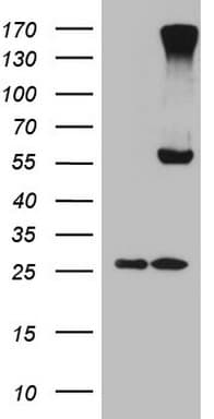 CPM / Carboxypeptidase M Antibody (aa124-423, clone OTI6C8)