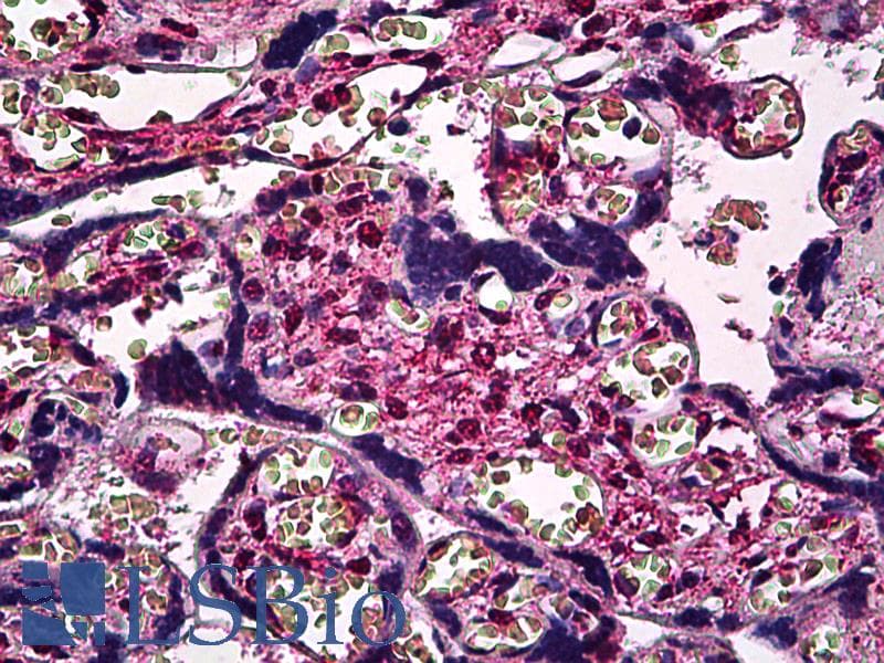 IHC-plus™ SMAD3 Antibody (clone 7F3)