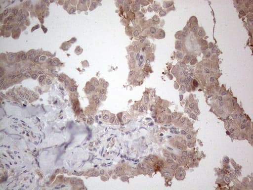 Monoclonal Mouse anti-Human ANGPTL8 / Betatrophin Antibody (clone OTI4G8, Carrier-free, aa22-198, IHC)