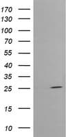 CMPK / CMPK1 Antibody (clone OTI1D7)
