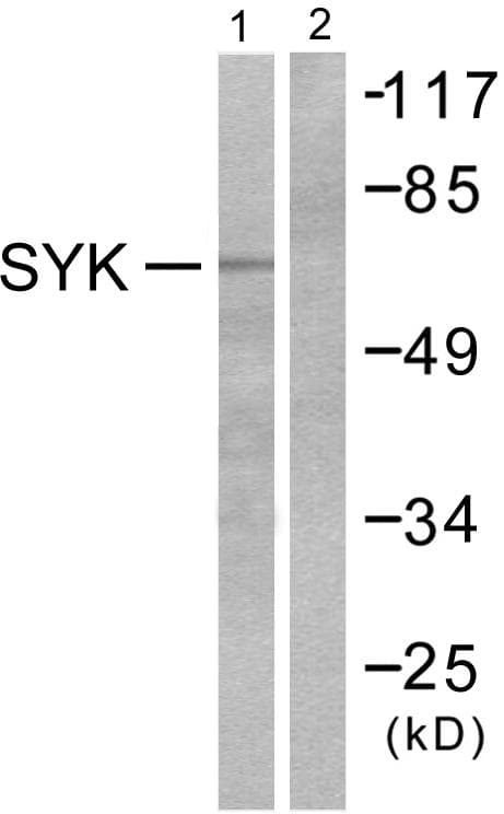 Polyclonal Rabbit anti-Human SYK Antibody (p525, IHC, WB)