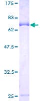 Human LACC1 Protein (Recombinant GST)