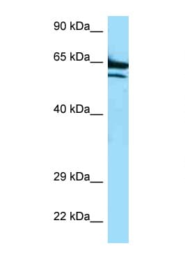 ADCK2 Antibody (aa523-572)