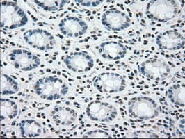 BRAF / B-Raf Antibody (clone OTI3E8)