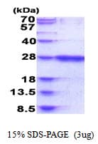 Human RAB39B Protein (Recombinant His)