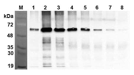 Monoclonal Mouse anti-Human FTO Antibody (clone AG103, IHC, WB)