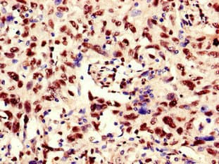RBM10 Antibody