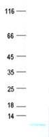 Human Protein PET100 homolog, mitochondrial (Recombinant His, N-Terminal)