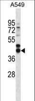 IHC-plus™ FST / Follistatin Antibody (aa312-340)