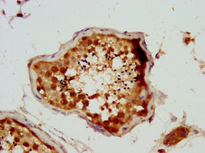 NSUN2 Antibody