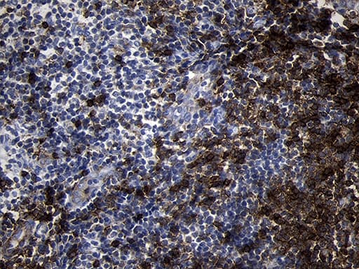 CD79B / CD79 Beta Antibody (clone OTI4E11)
