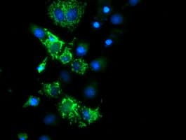 CYB5R1 Antibody (clone OTI4B7)