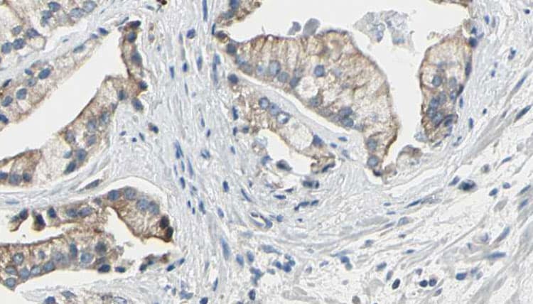 Polyclonal Rabbit anti-Human NPRA / NPR1 Antibody (IHC, WB)
