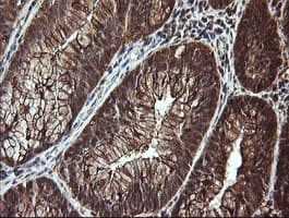 LGALS3 / Galectin 3 Antibody (clone OTI1A3)