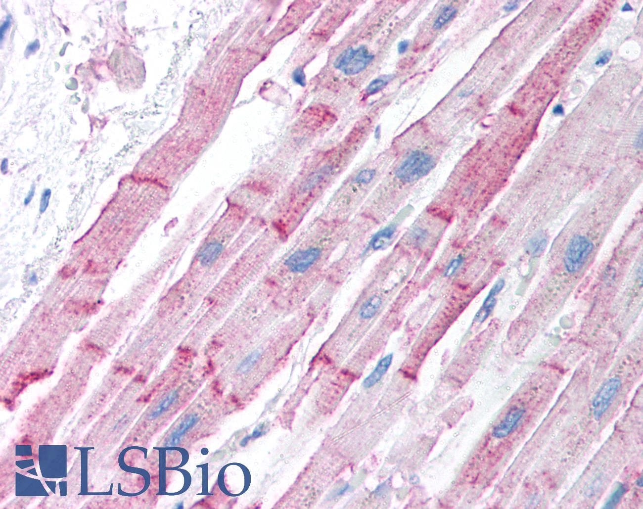 ESR2 / ER Beta Antibody (aa82-131)