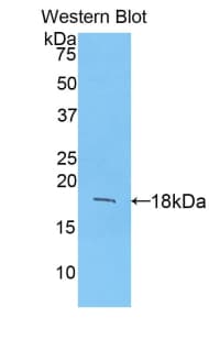 FGF1 / Acidic FGF Antibody (aa16-155, PE)