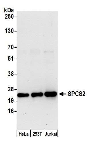 Polyclonal Rabbit anti-Human SPCS2 Antibody (aa25-75, WB)