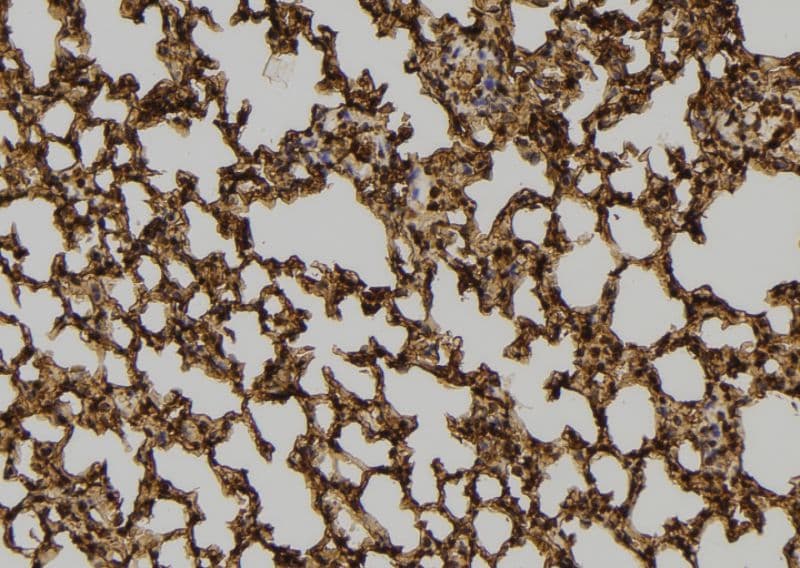 PEPD / PROLIDASE Antibody