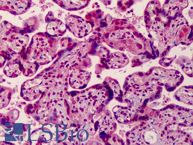 IHC-plus™ Polyclonal Rabbit anti-Human MED28 / Magicin Antibody (IHC, WB)