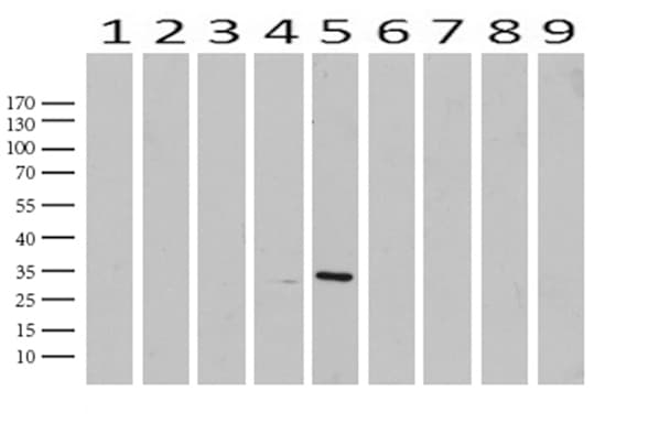 C14orf166 Antibody (clone UMAB182)
