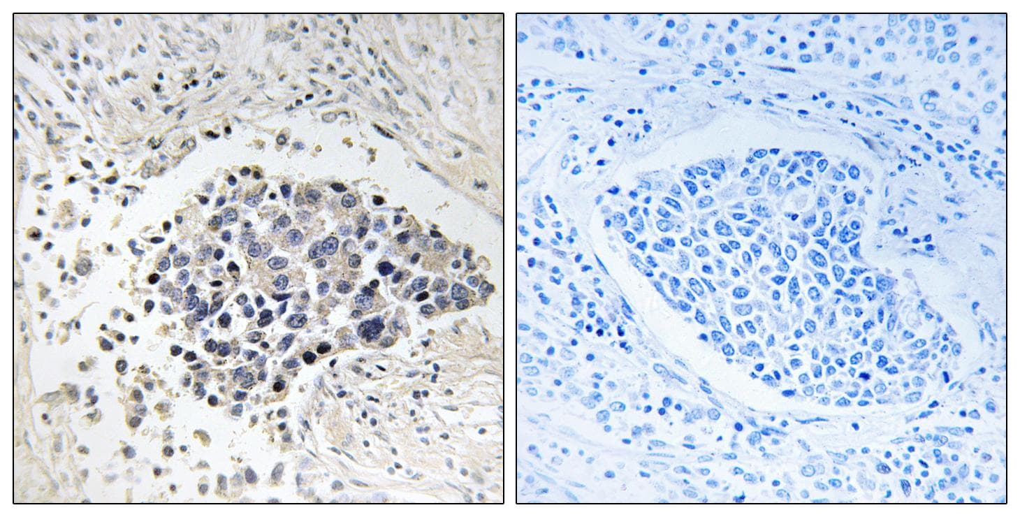 CPNE8 / Copine VIII Antibody