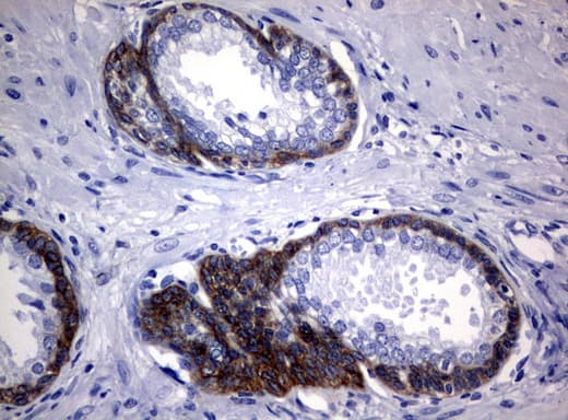 EGFR Antibody (clone UMAB95)