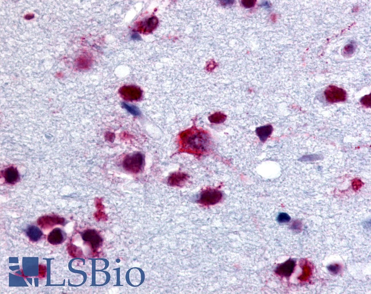 IHC-plus™ GPBB / PYGB Antibody (C-Terminus)