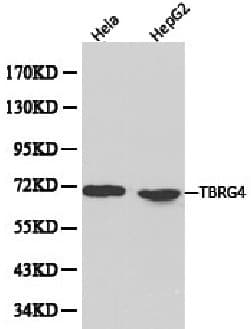 Polyclonal Rabbit anti-Human TBRG4 Antibody (IHC, WB)