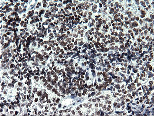 Monoclonal Mouse anti-Human ARNTL / BMAL1 Antibody (clone OTI1H6, IHC, WB)