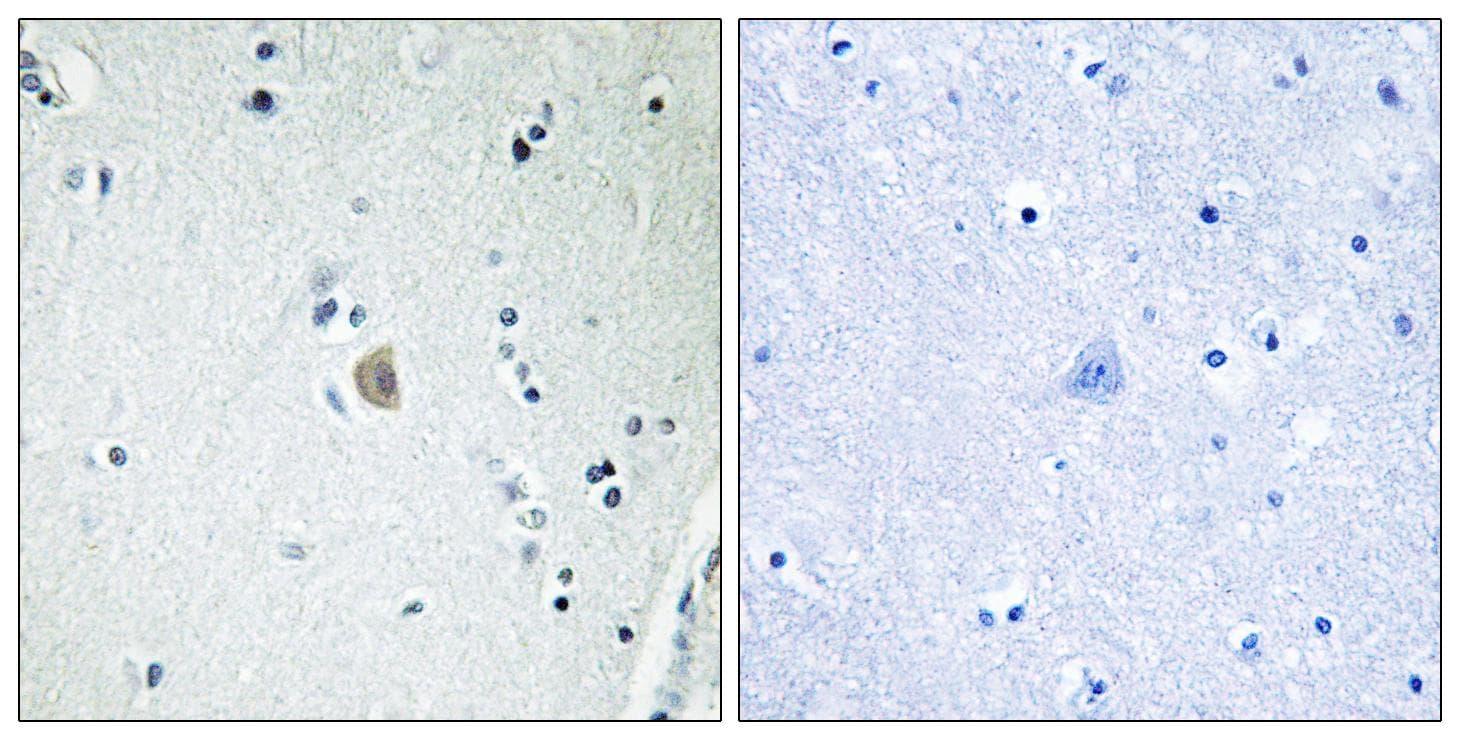CYP2E1 Antibody