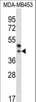 Polyclonal Rabbit anti-Human PPT2 Antibody (aa183-212, IHC, WB)