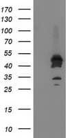 ASCC1 Antibody (clone OTI1E2)
