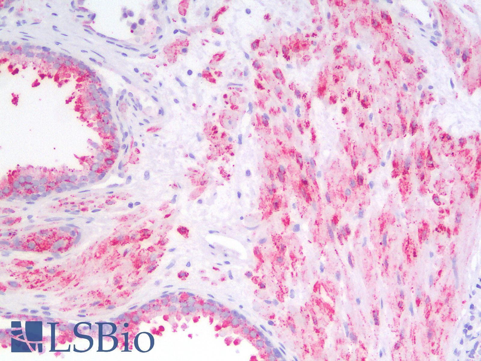 IHC-plus™ MMP2 Antibody
