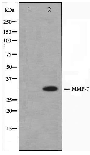 MMP7 / Matrilysin Antibody