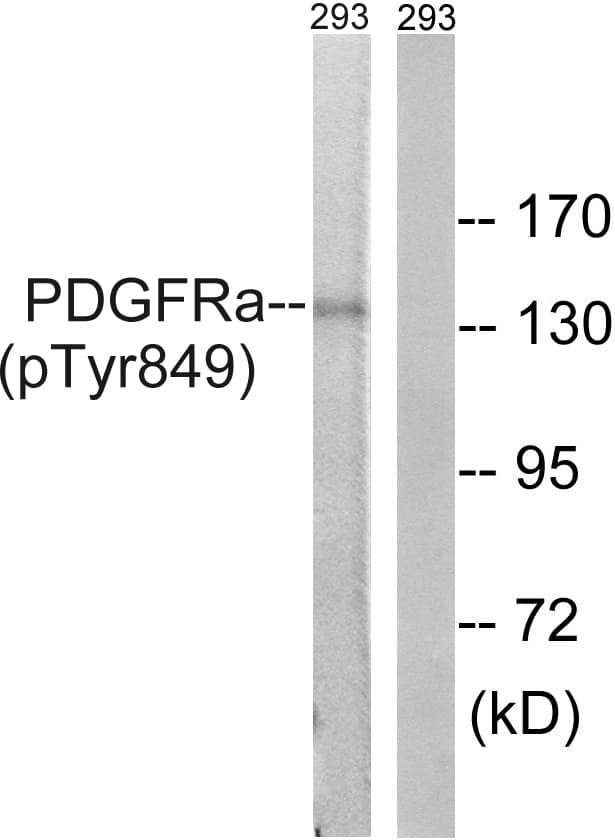 PDGFRA / PDGFR Alpha Antibody (phospho-Tyr849)