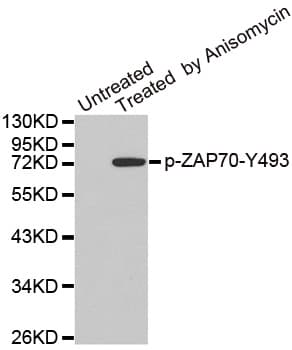 Polyclonal Rabbit anti-Human ZAP70 Antibody (phospho-Tyr493, IHC, WB)
