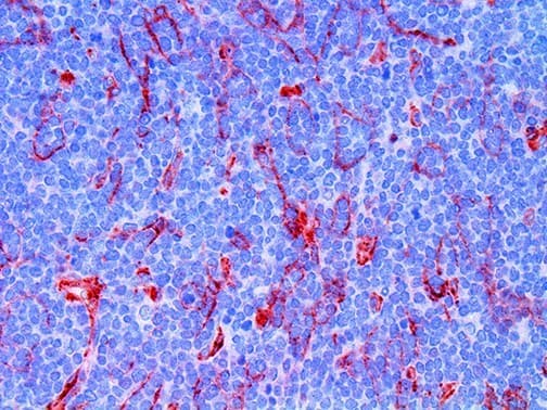 CD276 / B7-H3 Antibody (clone RBT-B7H3)