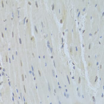 Polyclonal Rabbit anti-Human HNRNPK / hnRNP K Antibody (IHC, IF, WB)