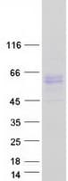 Human ALK2 / ACVR1 Protein (Recombinant Myc-DDK (Flag))