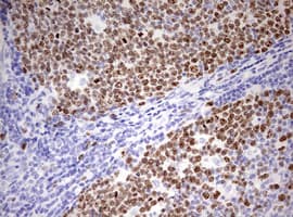 MKI67 / Ki67 Antibody (aa1160-1493, clone OTI18G5)