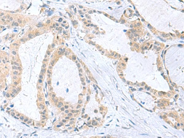 PDE6D / PDE6 Delta Antibody