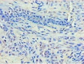 HDAC8 Antibody (aa1-377)
